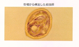 砂場から検出した回虫卵